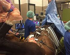 Diamant's Ablation Surgery-This is no Horse Sense